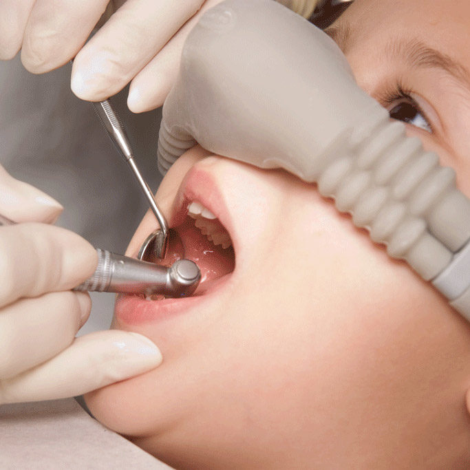 Nitrous Oxide (laughing gas) can help alleviate mild dental anxiety.