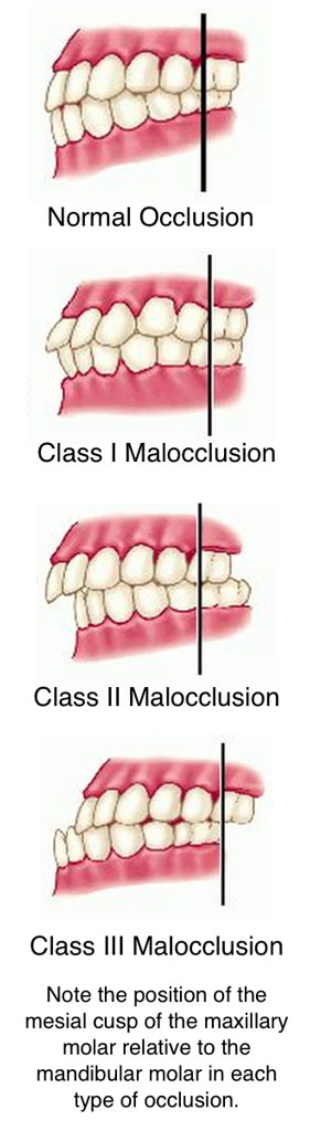 Orthodontic Evaluation