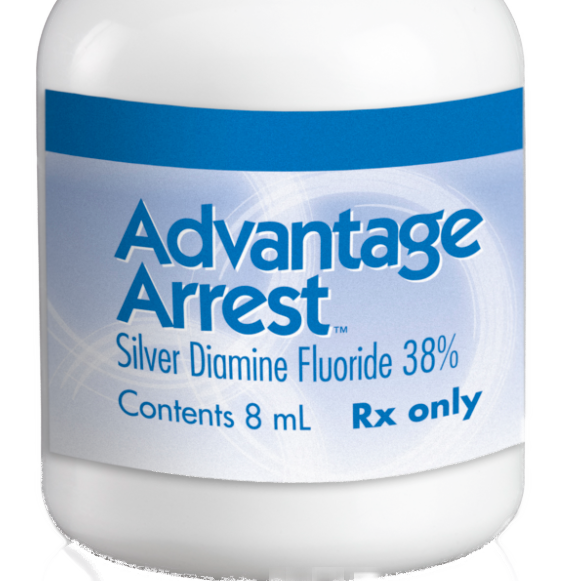 silver diamine fluoride toothpaste