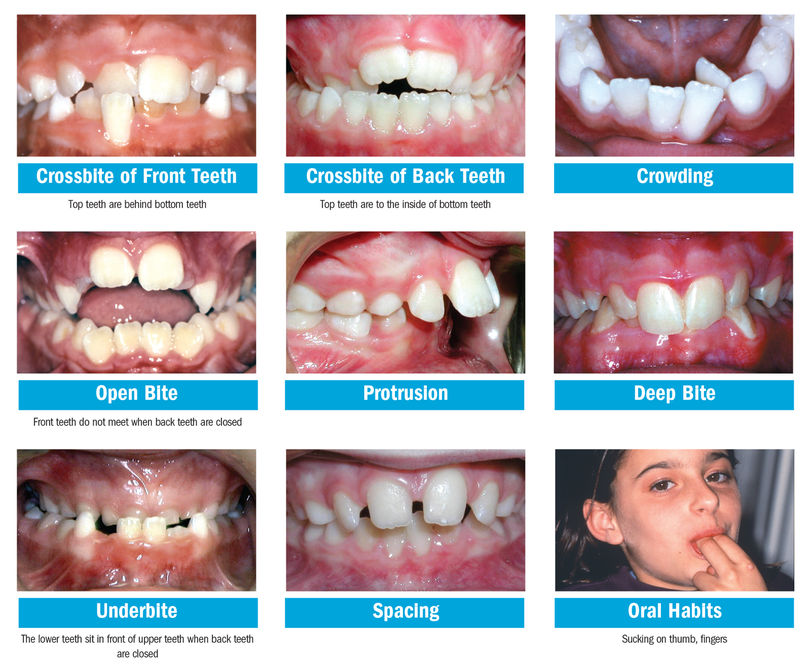 Pediatric Dentist Frisco Kids Dentistry - possible problems