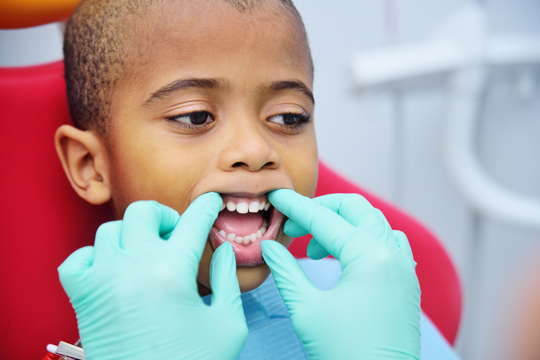 Pediatric Dentist Frisco Kids Dentistry - baby teeth